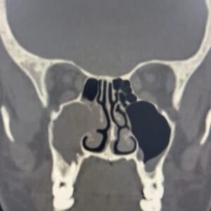 Screenshot_20250505_160925_Instagram